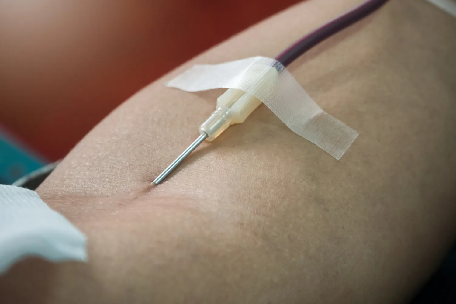 Cateterismo derecho y trombrofragmentación